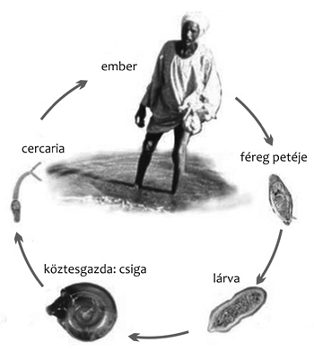 schistosomiasis a vizeletben